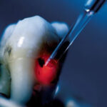 Dentistionline: corso di Formazione sulla sicurezza Laser